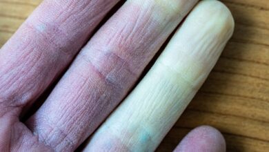 Pourquoi les doigts changent-ils de couleur ?