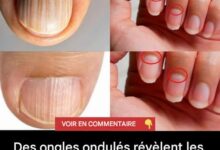 Des ongles ondulés révèlent les secrets d’une possible maladie